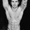 mens underarm laser hair removal Paddington Sydney